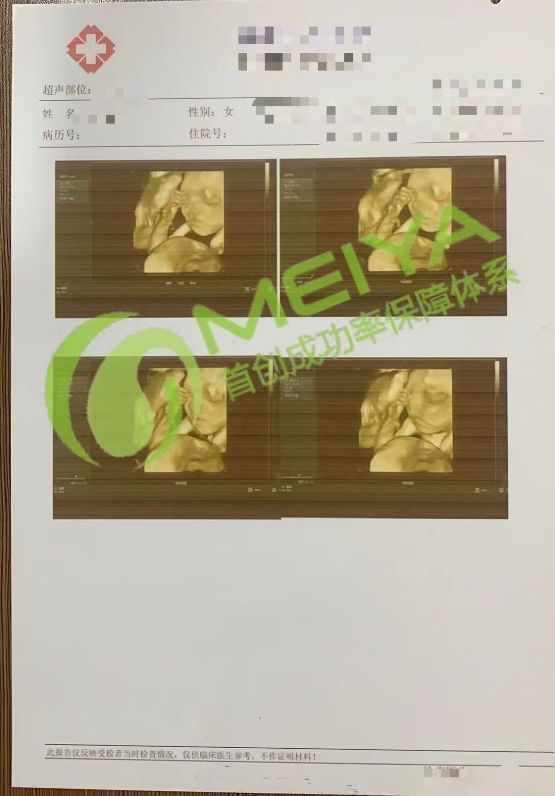 恭喜邯郸Q先生，胎心复查通过(图3)
