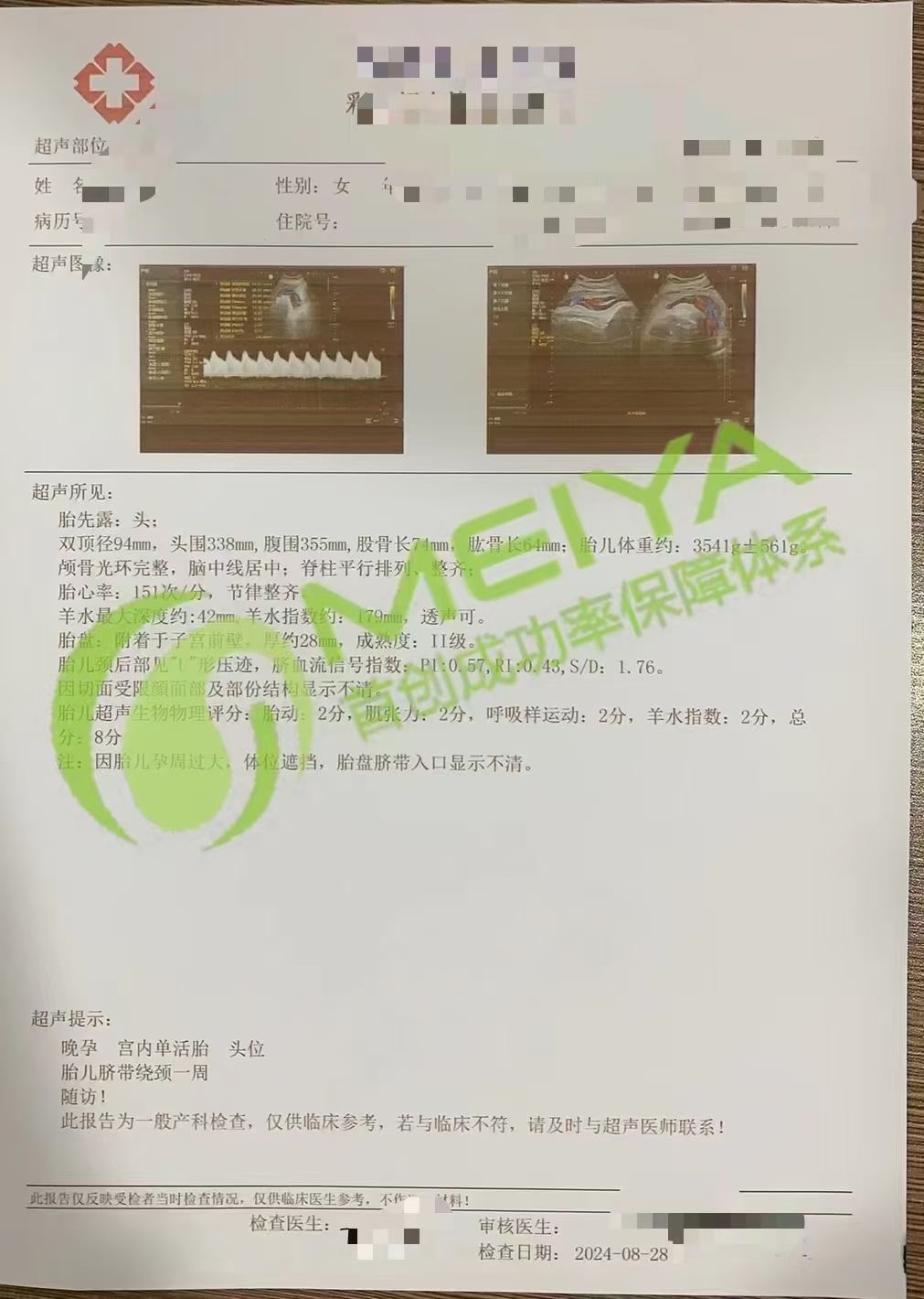 恭喜邯郸Q先生，胎心复查通过(图1)
